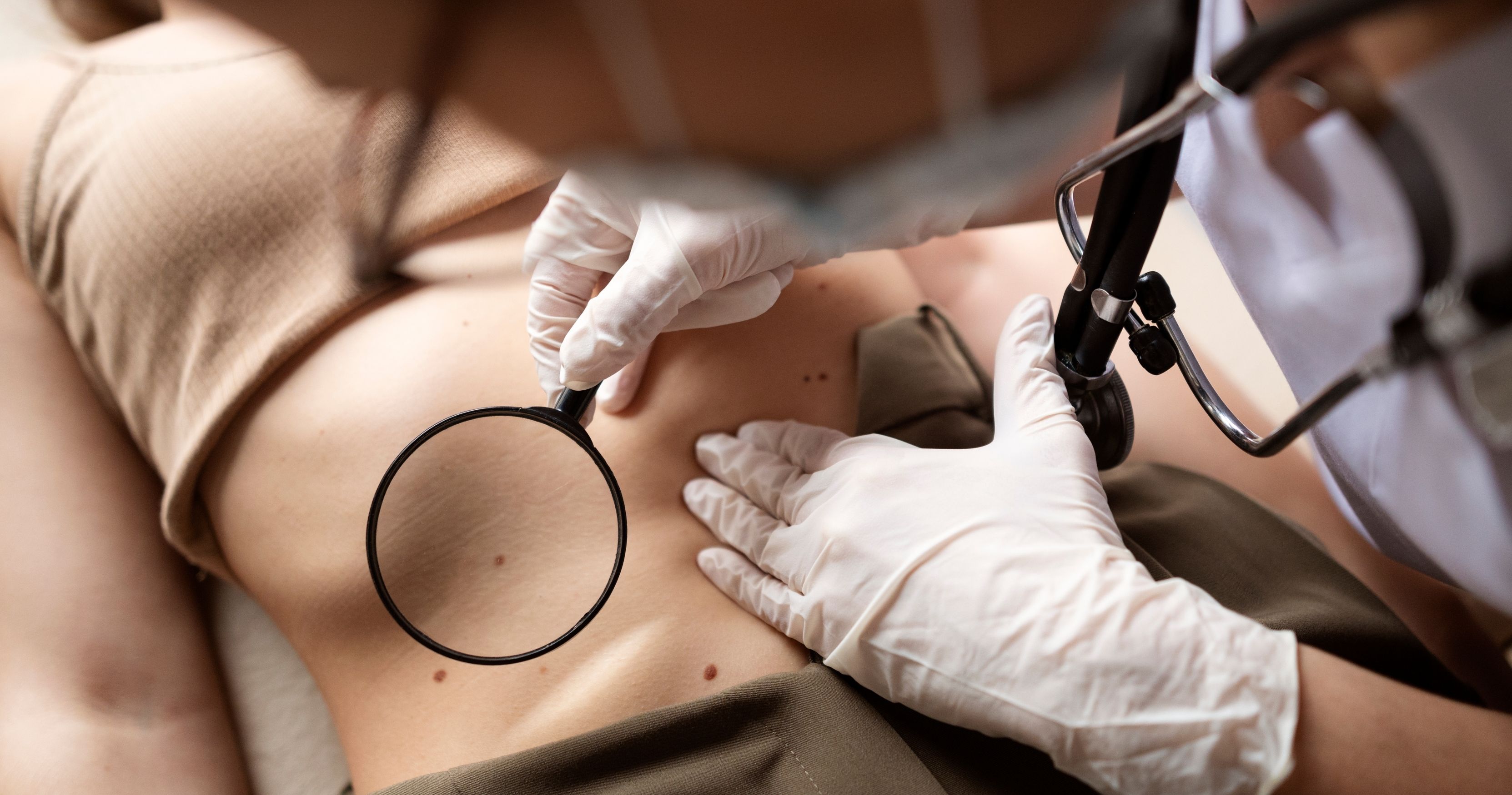 Avaliação de pele com lupa na Dermacenter