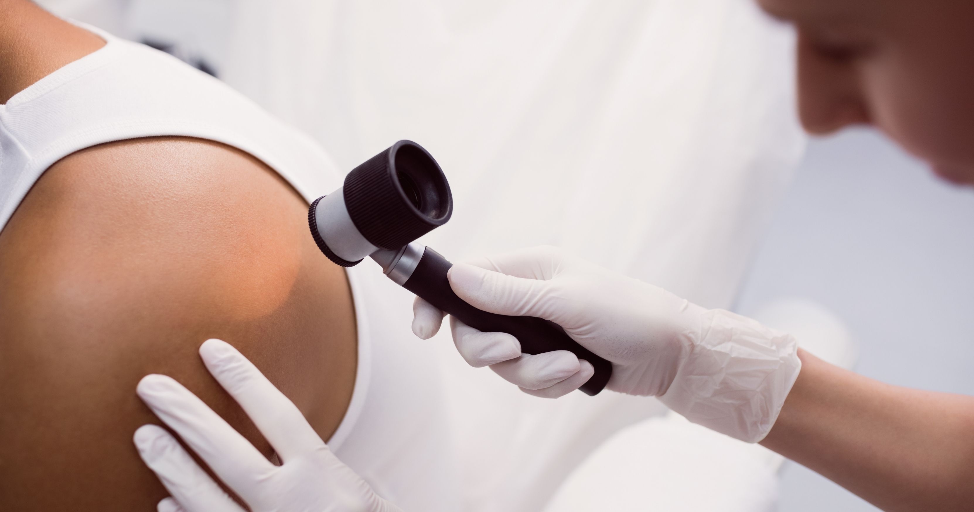 Avaliação dermatológica com dermatoscópio na Dermacenter